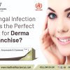 Why Fungal Infection Cream is the Perfect Product for Derma PCD Franchise?
